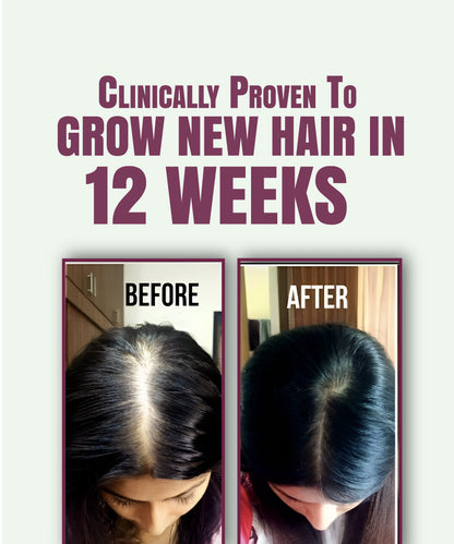 Umkash Organic Hair Growth Oil by Umhashco